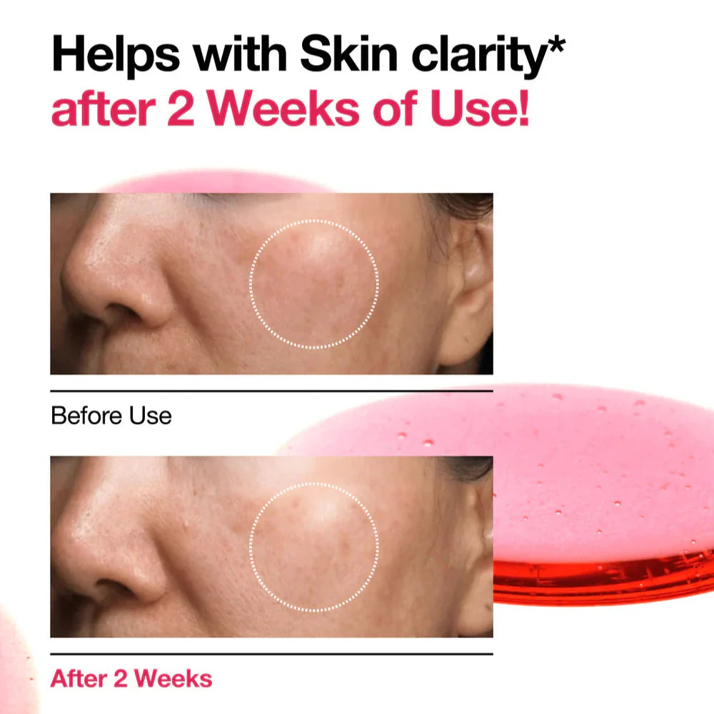 Anua Niacinamide 10%+TXA 4% Dark Spot Correcting Serum